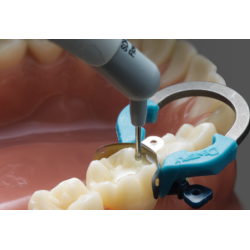Palodent V3 inel, Dentsply