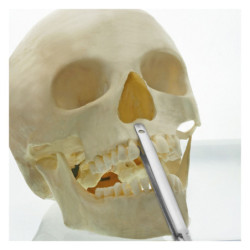 Penseta chirurgicala Arnohold 220 mm dreapta, Medesy 1540