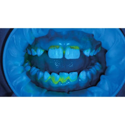 Plaque Test Refill 11g, Ivoclar