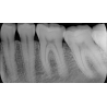 Scaner digital cu placute fosforice ProXam iP, KaVo
