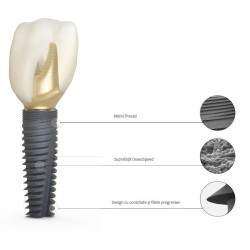 Implant PrimeTaper EV D4.2 mm, Dentsply Sirona