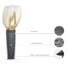 Implant PrimeTaper EV D4.2 mm, Dentsply Sirona