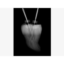 Tri Auto ZX 2, motor endodontic cu apex locator, Morita