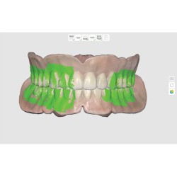 Scanner Intraoral i700, Medit