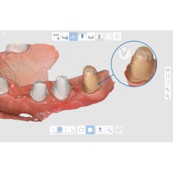 Scanner Intraoral i700, Medit