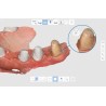 Scanner Intraoral i700, Medit